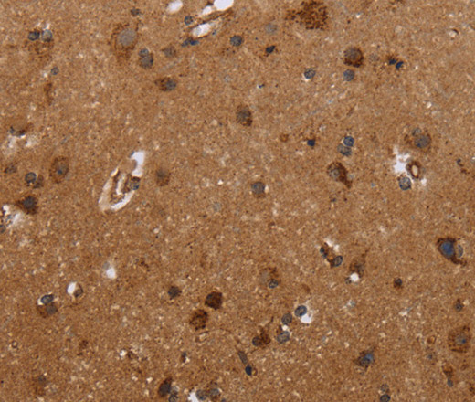 Immunohistochemistry of paraffin-embedded Human brain  tissue using FMN2 Polyclonal Antibody at dilution 1:30