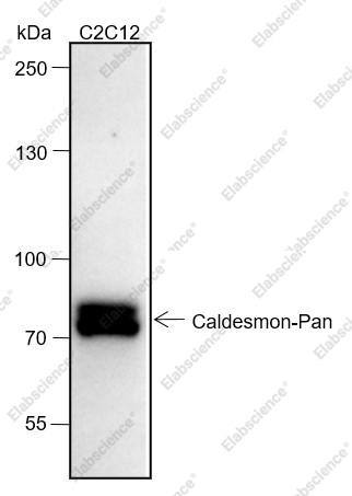 Recombinant Caldesmon/CDM Monoclonal Antibody - 1