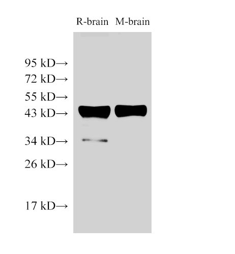 Western Blot analysis of Rat brain and Mouse brain using beta actin Polyclonal Antibody at dilution of 1:2000