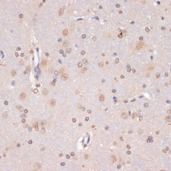 Immunohistochemistry of paraffin-embedded Rat brain using PIDD Polyclonal Antibody at dilution of  1:100 (40x lens).