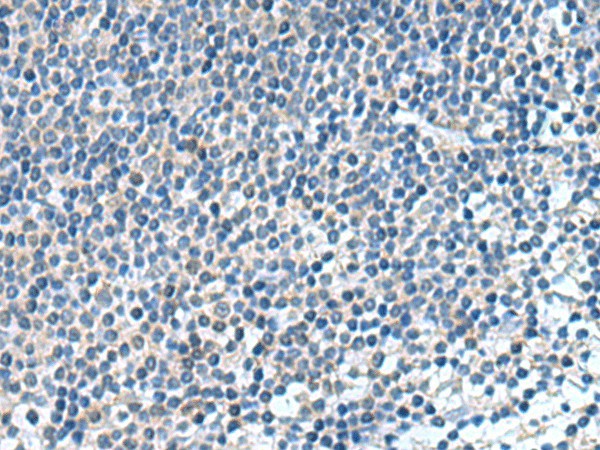 Immunohistochemistry of paraffin-embedded Human tonsil tissue  using KIF2A Polyclonal Antibody at dilution of 1:65(?200)