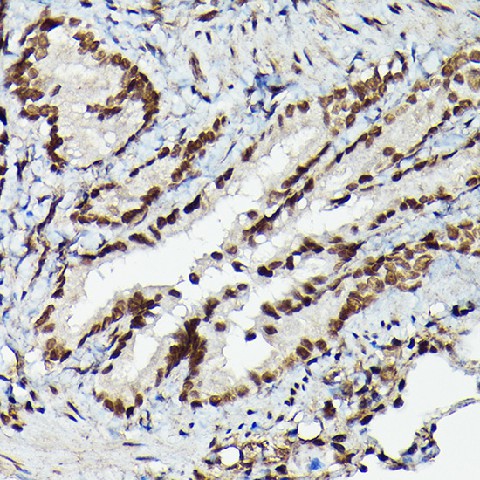 Immunohistochemistry of paraffin-embedded rat lung using Fam50b Polyclonal Antibody at dilution of 1:50 (40x lens).Perform high pressure antigen retrieval with 10 mM citrate buffer pH 6.0 before commencing with IHC staining protocol.