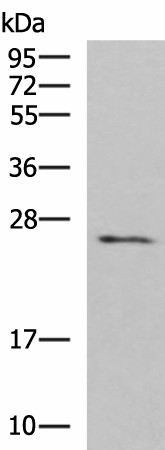 Western blot analysis of Human fetal brain tissue lysate  using CLEC4D Polyclonal Antibody at dilution of 1:700