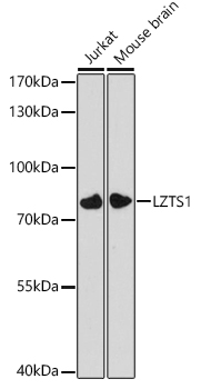 Western blot analysis of extracts of various cell lines using LZTS1 Polyclonal Antibody at 1:3000 dilution.