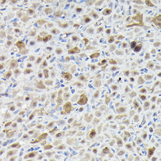 Immunohistochemistry of paraffin-embedded rat ovary using SNRPE Polyclonal Antibody at dilution of 1:50 (40x lens).Perform high pressure antigen retrieval with 10 mM citrate buffer pH 6.0 before commencing with IHC staining protocol.