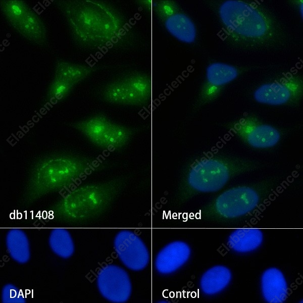 Recombinant PA28A/PSME1 Monoclonal Antibody - 2