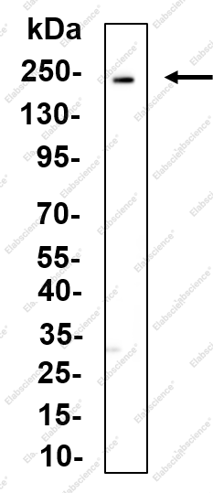 Recombinant RB1CC1 Monoclonal Antibody - 1