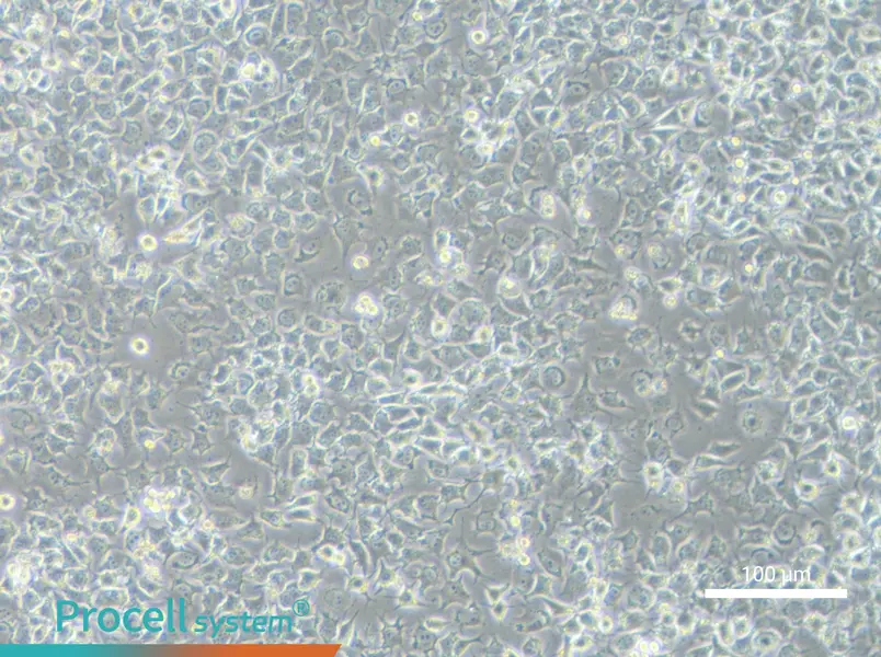 92-1 [Human uveal melanoma]92-1 [Human uveal melanoma] - 3