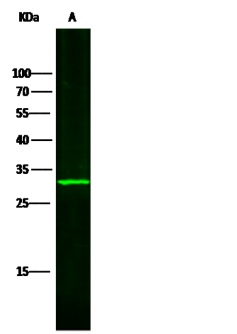 SULT1A1 Monoclonal Antibody - small - 2