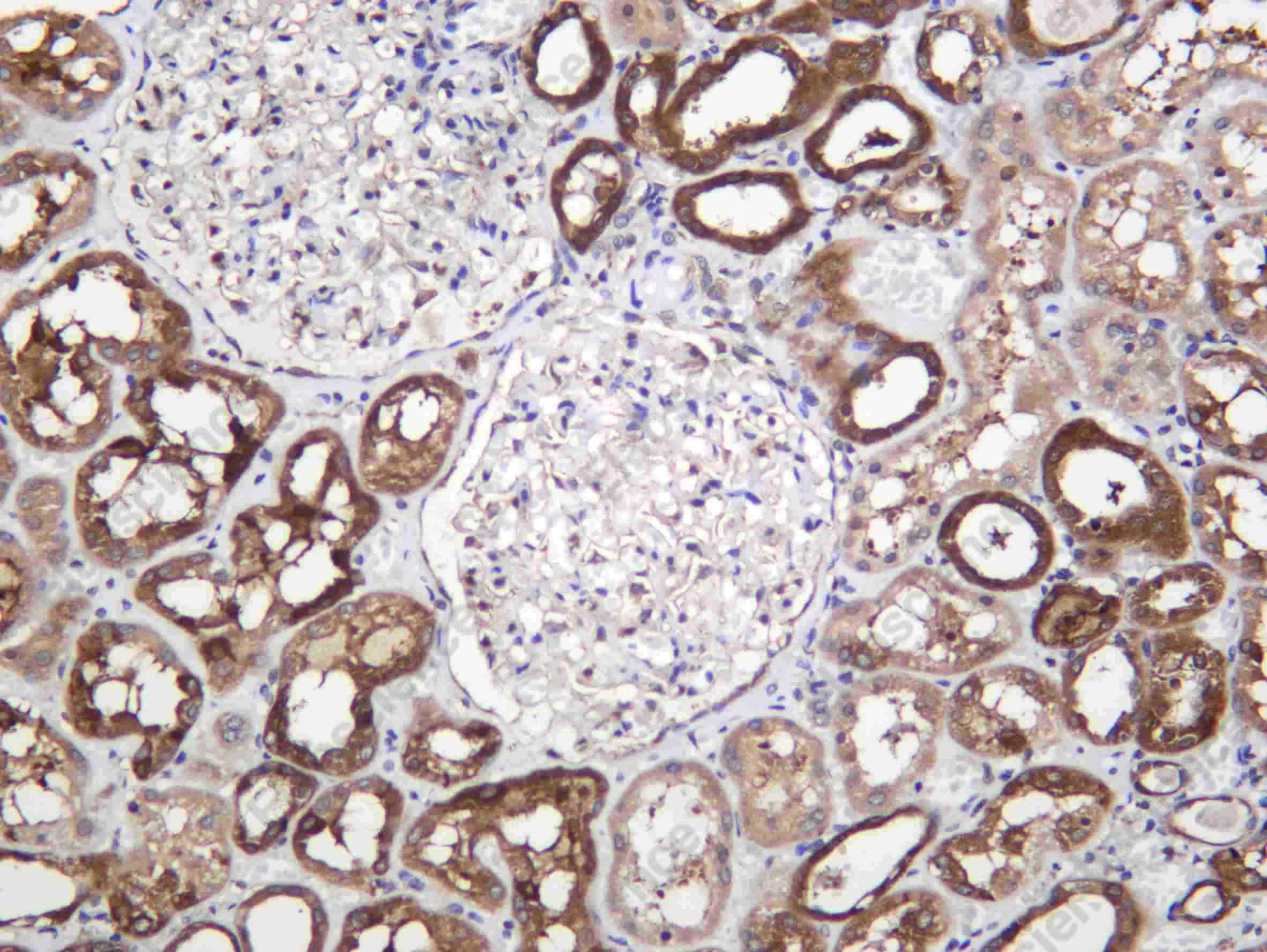 Recombinant HPRT Monoclonal Antibody - 1