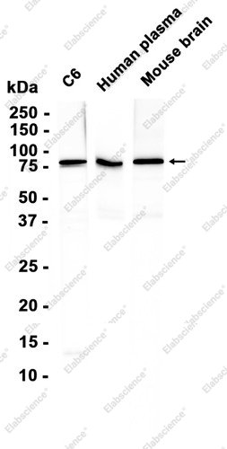 Recombinant Gelsolin Monoclonal Antibody - 2