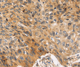 JNK2 Polyclonal Antibody - 2