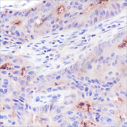 Recombinant CEACAM1 Monoclonal Antibody - 2