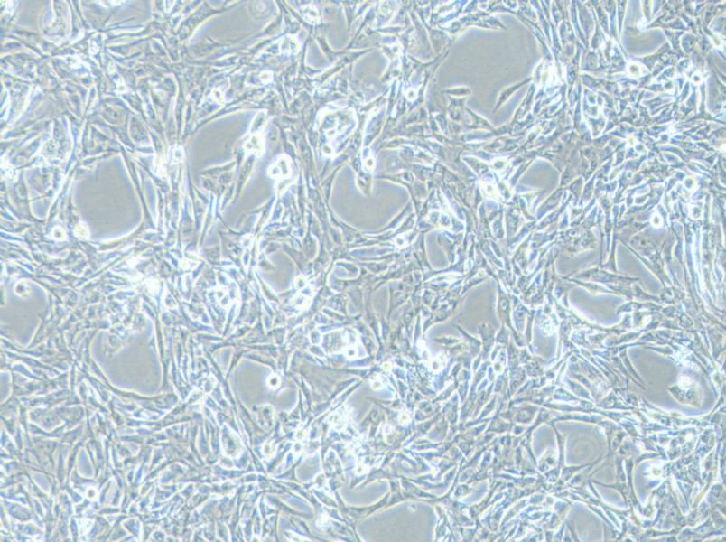 NCI-H1975 Cell Complete Medium - 3