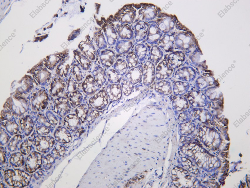 Recombinant PTGER2 Monoclonal Antibody - 3