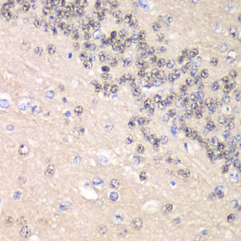 Immunohistochemistry of paraffin-embedded rat brain using Cyclin C Polyclonal Antibody at dilution of 1:100 (40x lens).Perform microwave antigen retrieval with 10 mM PBS buffer pH 7.2 before commencing with IHC staining protocol.