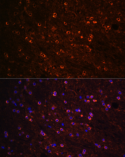 Immunofluorescence analysis of Rat brain using Tau Polyclonal Antibody at dilution of  1:100 (40x lens). Blue: DAPI for nuclear staining.