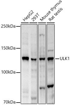 Western blot analysis of extracts of various lysates using ULK1 Polyclonal Antibody at 1:2000 dilution.