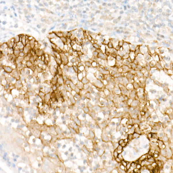 Immunohistochemistry of paraffin-embedded human tonsil using FXYD3 Polyclonal Antibody at dilution of 1:100 (40x lens).Perform high pressure antigen retrieval with 10 mM citrate buffer pH 6.0 before commencing with IHC staining protocol.