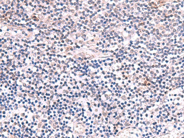 Immunohistochemistry of paraffin-embedded Human tonsil tissue  using INPP5K Polyclonal Antibody at dilution of 1:85(?200)