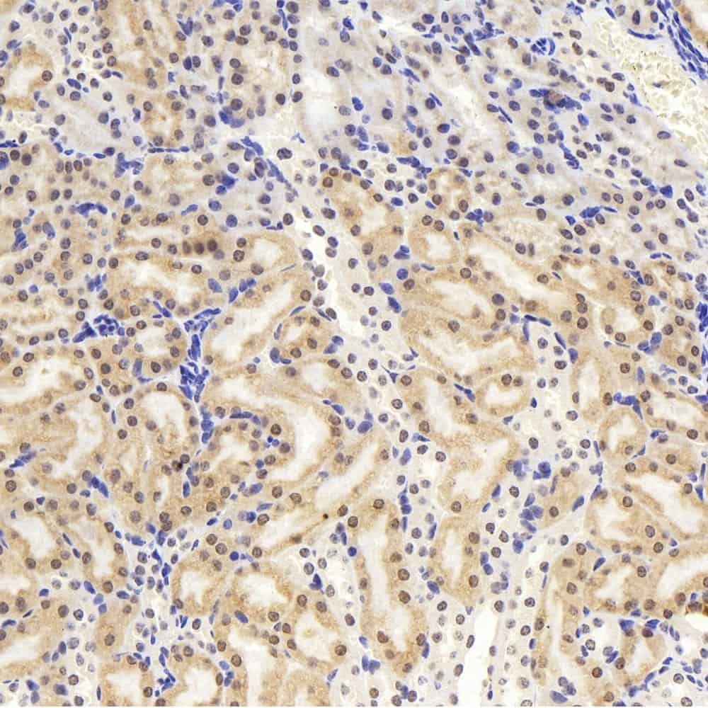 Immunohistochemistry analysis of paraffin-embedded mouse kidney  using JUN Polyclonal Antibody at dilution of 1:1000.