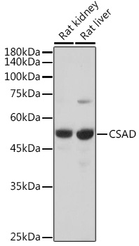 Western blot analysis of extracts of various cell lines using CSAD Polyclonal Antibody at 1:5000 dilution.