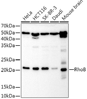 Western blot analysis of extracts of various cell lines using RhoB Polyclonal Antibodyaat 1:1000 dilution.