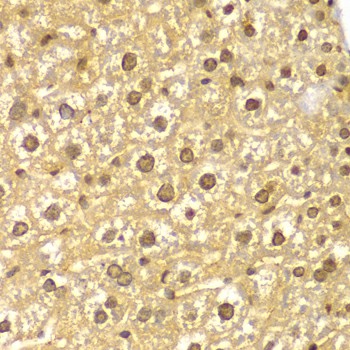 Immunohistochemistry of paraffin-embedded Mouse liver using ASC / TMS1 Polyclonal Antibody at dilution of 1:100 (40x lens).
