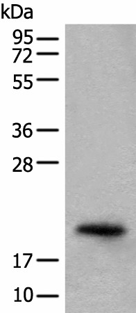 Western blot analysis of Mouse eye tissue lysate  using CRYGS Polyclonal Antibody at dilution of 1:800