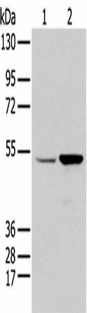 Western blot analysis of HEPG2 and 231 cell  using EGR2 Polyclonal Antibody at dilution of 1:350