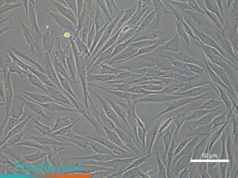 Human Mammary Cancer Fibroblast Complete Medium - small - 5