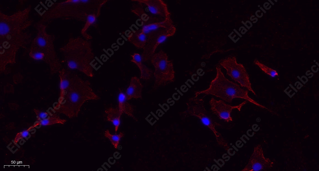 Recombinant PERK Monoclonal Antibody - 3