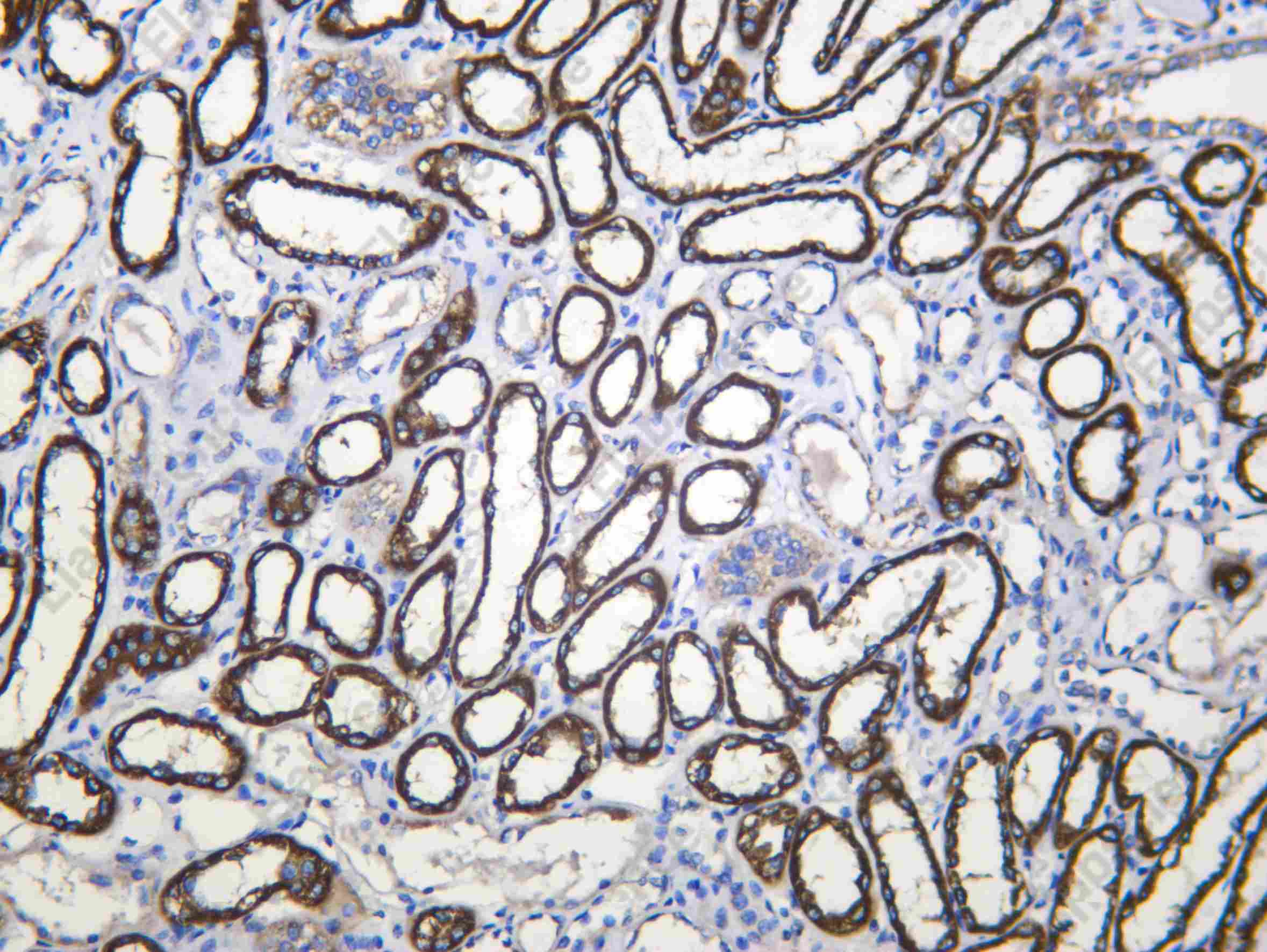 Recombinant CP27B Monoclonal Antibody - 1