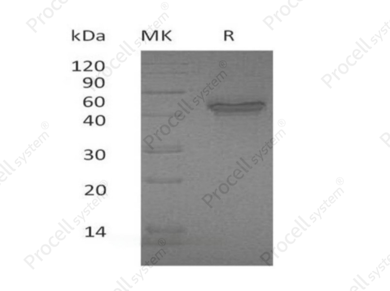 IL-12B/IL-12 p40, Human, Recombinant