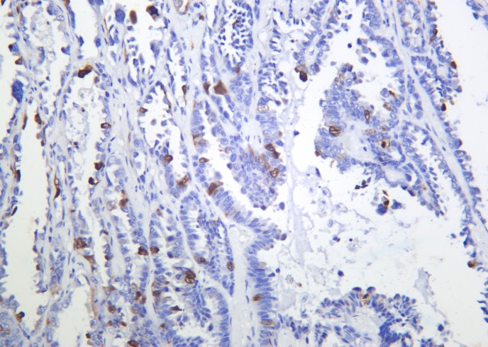 Recombinant Phospho-CDK1, 2 (Thr14) Monoclonal Antibody-searchlist-1
