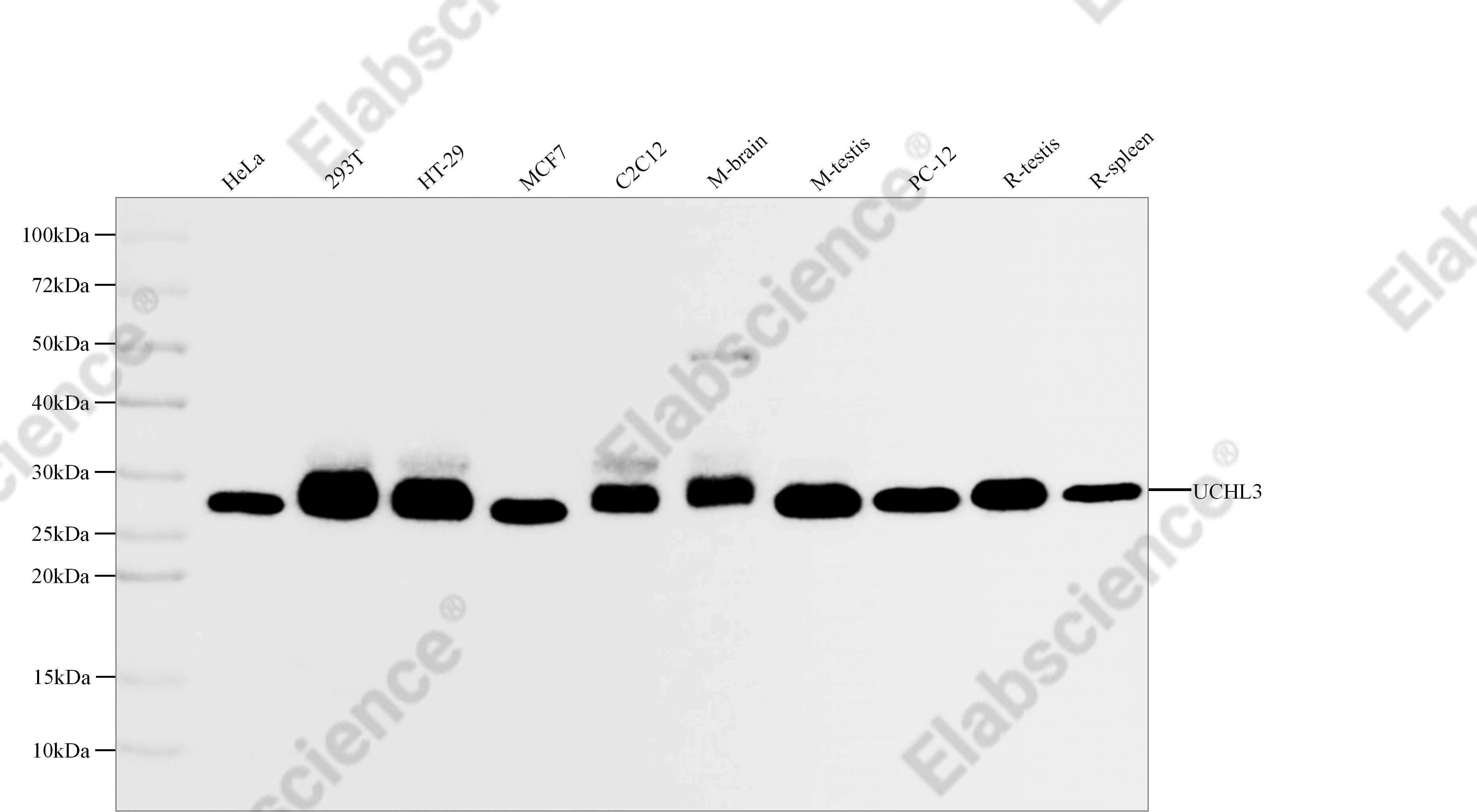 Recombinant UCHL3 Monoclonal Antibody - 1