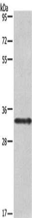 Western Blot analysis of Jurkat cell using IL1A Polyclonal Antibody at dilution of 1:666