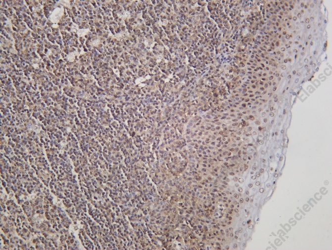 Recombinant HP1γ Monoclonal Antibody - 1