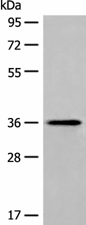 Western blot analysis of Human liver tissue lysate  using MLST8 Polyclonal Antibody at dilution of 1:400