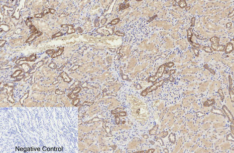 Immunohistochemistry of paraffin-embedded Human kidney tissue using Cleaved-CASP8 (D384) Polyclonal Antibody at dilution of 1:200.