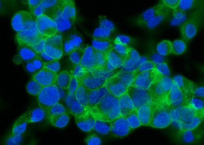 Recombinant ASGR2/ASGPR2 Monoclonal Antibody - small - 2