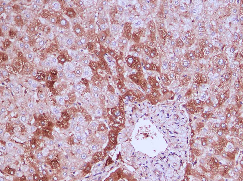 HA-Tag Polyclonal Antibody-产品推荐-1