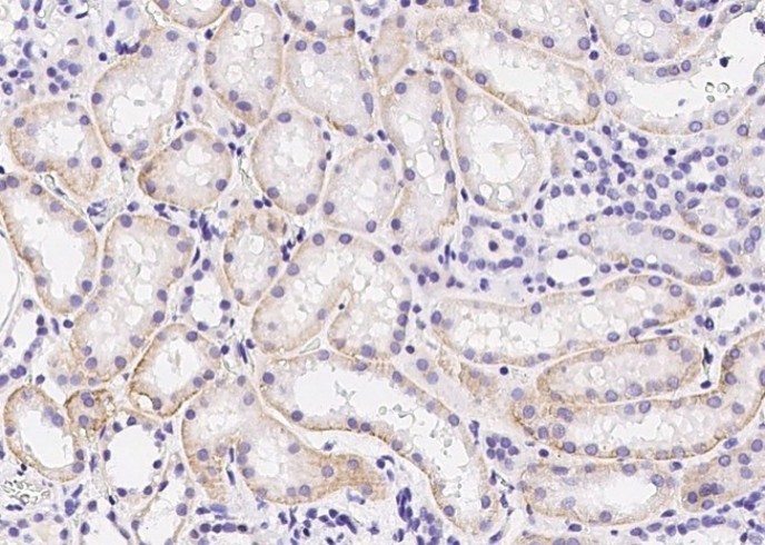 Insulin Receptor/INSR/CD220 Monoclonal Antibody - small - 2