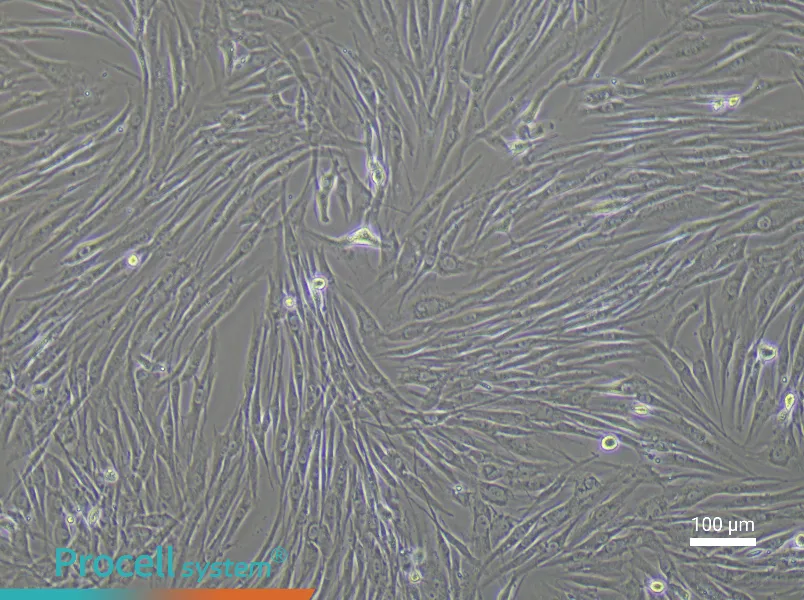 Human Uterine Fibroids Tissue-Derived Cell Complete Medium - 2