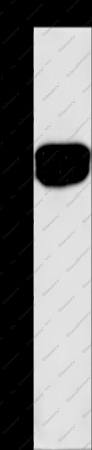 SDCCAG3 Polyclonal Antibody - 1