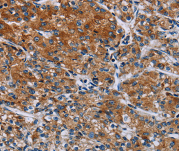 HYAL3 Polyclonal Antibody - 3