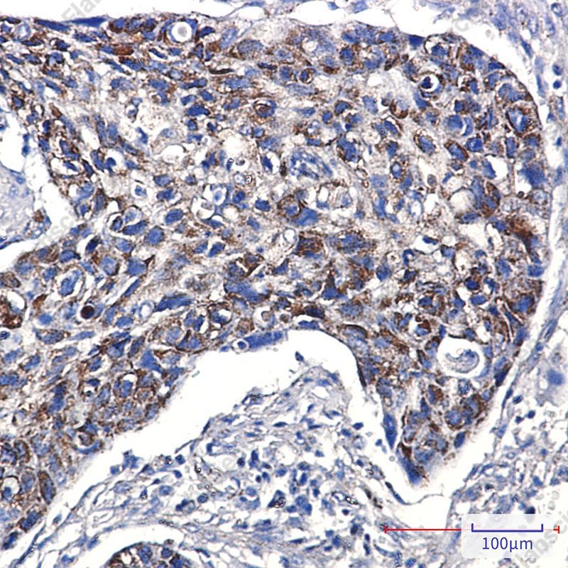 Recombinant TTC11 Monoclonal Antibody - 2