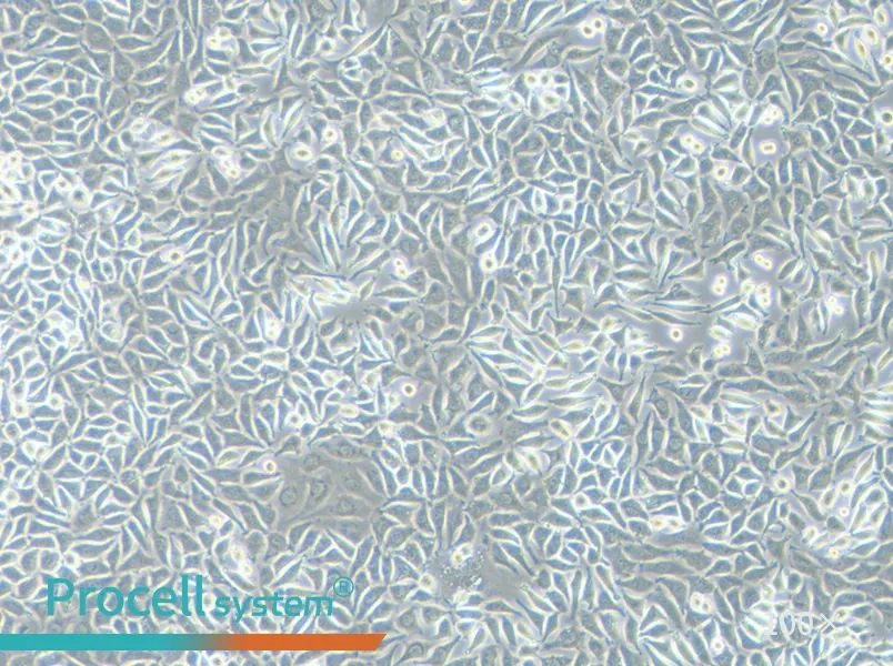 NCTC clone 929 Cell Complete Medium - 2