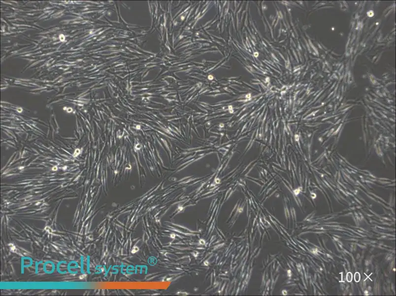 MeWo Cell Complete Medium - 1