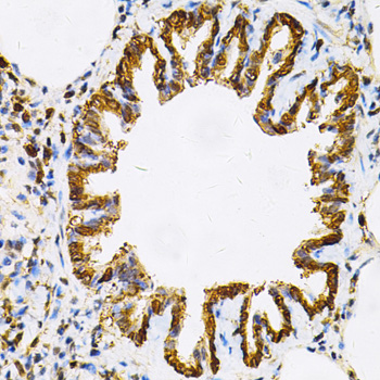 Immunohistochemistry of paraffin-embedded Rat lung using HSP90AB1 Polyclonal Antibody at dilution of 1:100 (40x lens).
